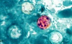 México confirma tres casos de Cyclospora; Salud descarta brote en el país